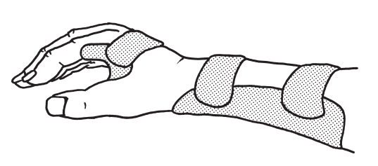 コックアップスプリント